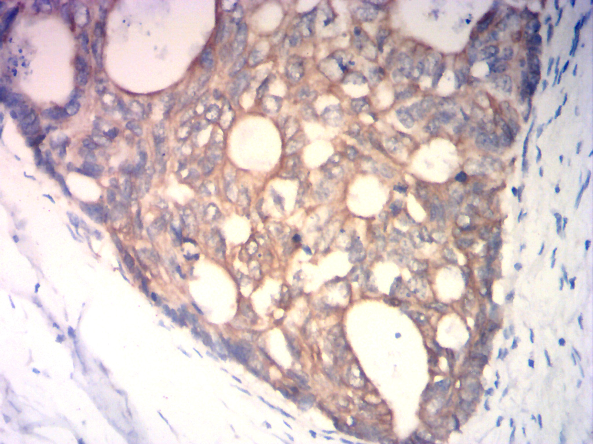 IHC